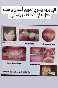 تقويم اسنان • كلية طب الاسنان • الرمادي