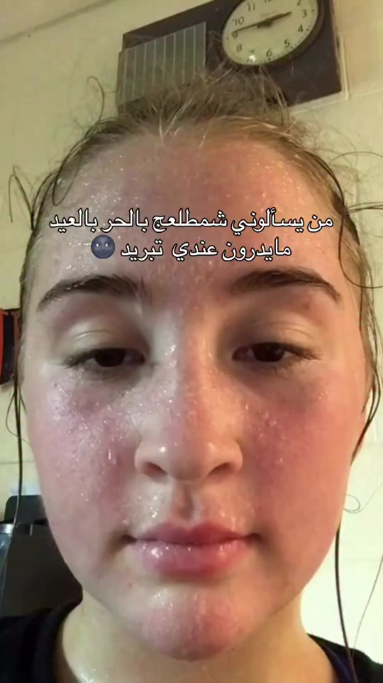 مروحة رقبة شحن 


**إذا كنت صاحب هذا الإعلان وتريد حذفه لأي سبب، رجاءا أرسل رسالة إلى الدعم الفني**