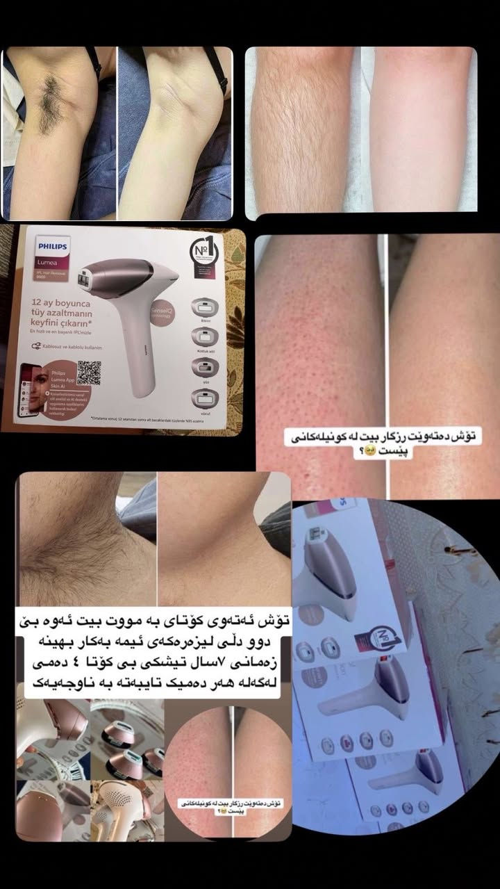 باشترین لیزەر ئۆرجینالە بە 220هەزار😍


**إذا كنت صاحب هذا الإعلان وتريد حذفه لأي سبب، رجاءا أرسل رسالة إلى الدعم الفني**