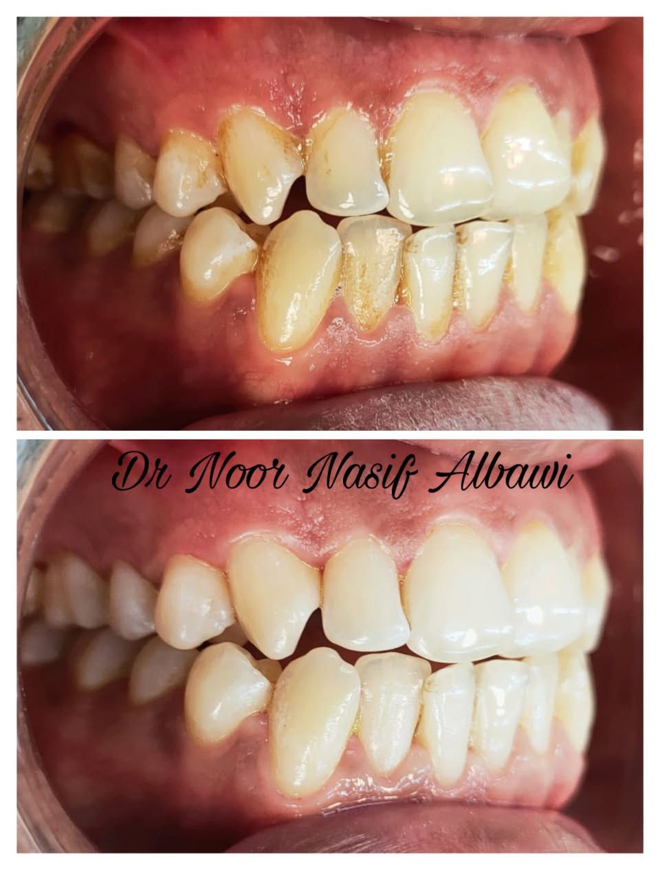 يعلن مركز الماس عن تواجد الدكتورة نور الباوي
في شهر رمضان ايام ( سبت / احد / اثنين / ثلاثاء) 
من الساعة ٧ الى ساعة ١٠ مساءا

📍بغداد / الحسينية / شارع الجريخي بناية مطعم جكن اوسلو سابقاً ( الطابق الارضي) 

للحجز والاستفسار 👈 ***********
