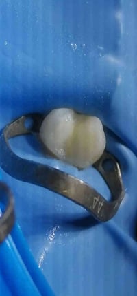 د.مهند عبدالجواد • ماجستير تعويض الأسنان • سايدين مستشفى القياره