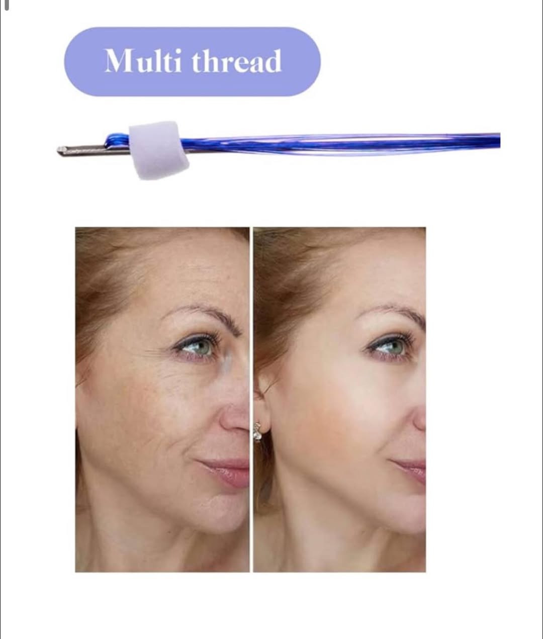 خيوط شد الوجه
طلعو ب dhl
الي يفيدة ينطي سعر


**إذا كنت صاحب هذا الإعلان وتريد حذفه لأي سبب، رجاءا أرسل رسالة إلى الدعم الفني**