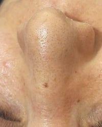 تنظيف بشرة • فتح مسام • نضارة الوجه