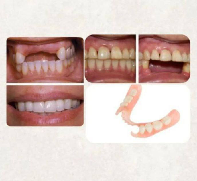 السلام عليكم 
اي شخص محتاج قلع

او تعويض الاسنانه بطقم جزئي متحرك

 يتواصل وياي 
العمل مجانا داخل عيادات الجامعه الوطنيه 
@E_N_R4
***********
