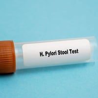 فحص جرثومة المعدة • فحص براز • مختبر الكفيل التخصصي