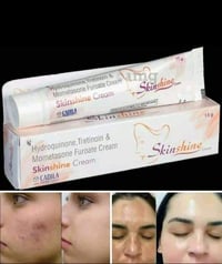 علاج الكلف • كريم سكين شين • هايدروكينون