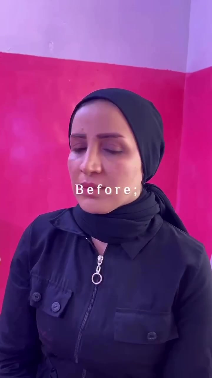 جمال التغير الشامل   بعيادتنا 

أحيانًا لمسة بسيطة تغيّر إحساسك 
بالكامل…
نضارة، تحديد، توازن، وثقة تنعكس على كل ملامحك.
التجميل اللاجراحي مو تغيير لشخصيتك، هو إظهار أجمل نسخة منك. 💎
سارعي بالحجز  بعيادة الرياحين ❤️
————————————
الحله/ حي الامام علي مقابل كرار ابو الكص 
***********
