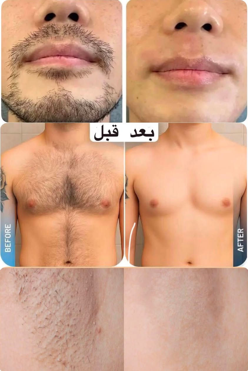 التوصيل مجاني ✌️
ليزر منزلي بسعر 40 الف


**إذا كنت صاحب هذا الإعلان وتريد حذفه لأي سبب، رجاءا أرسل رسالة إلى الدعم الفني**