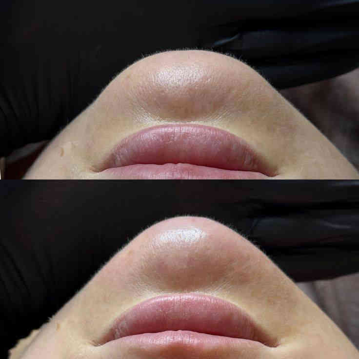 سوينه عروض 
✨تردين تسوين  تجميل ما عندج يمنه سعار مناسبا
عروض راس اسنه عروض جميلههه
*ابلازمه وجه 30💃🏻💃🏻
*ابلازمه وجه لتصبقات والكلف 40🔥🔥
*فلر شفه كوري ب30💋
*فلر شفه الفرنسي  ب35🔥💋
*فلر شفه باريسي ب50💋💃🏻
*فلر شفه اسويسري ب55💋🫂
*فلر وجنات  سيسي 35 (6جلسات)🙎🏻‍♀️
*نضاره الفائقه 45*
*ابرة العنبر الزعفرانيه ب40

*بوتوكس لرفع الحاجب  ب50🤎
*بوتوكس شد كصه ب50💆🏻‍♀️
*بوتوكس لتوسيع العين ب50🫣
*بوتوكس لشد التجاعيد 110🫢
*غمازه 25🔥🔥🔥
*تبييض البشرة ب70 ألف 💋💃🏻
*ابرة نضارة وتوريد وترطيب ب100الف 🔥🔥🔥
*علاج الگلف العميق 60 ألف 
*تعديل الأنف بل فلر ب45
*علاج داء الوردية ب30 ألف🔥🔥🔥🔥
*تغيرر شامل فلر فرنسي ايطالي 300
العنوان//كربلاء 
الستفسار /***********
