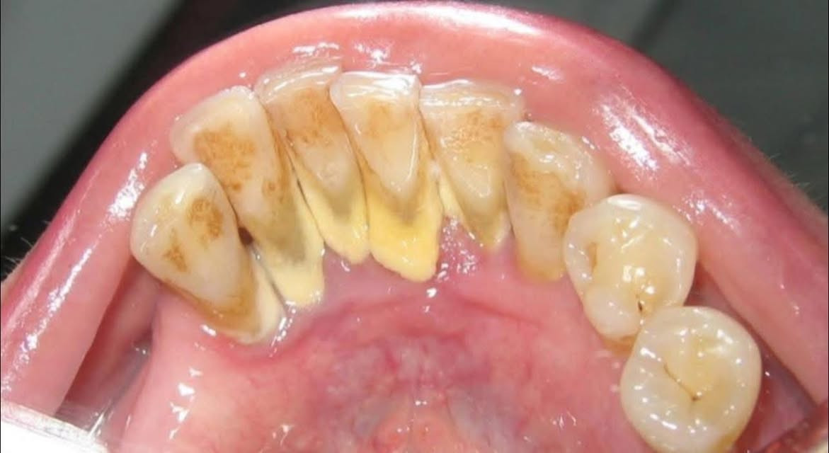 ‼️‼️🚨علاج مجاني تحت اشراف اطباء اختصاص
جامعة الفراهيدي كلية طب الاسنان


**إذا كنت صاحب هذا الإعلان وتريد حذفه لأي سبب، رجاءا أرسل رسالة إلى الدعم الفني**