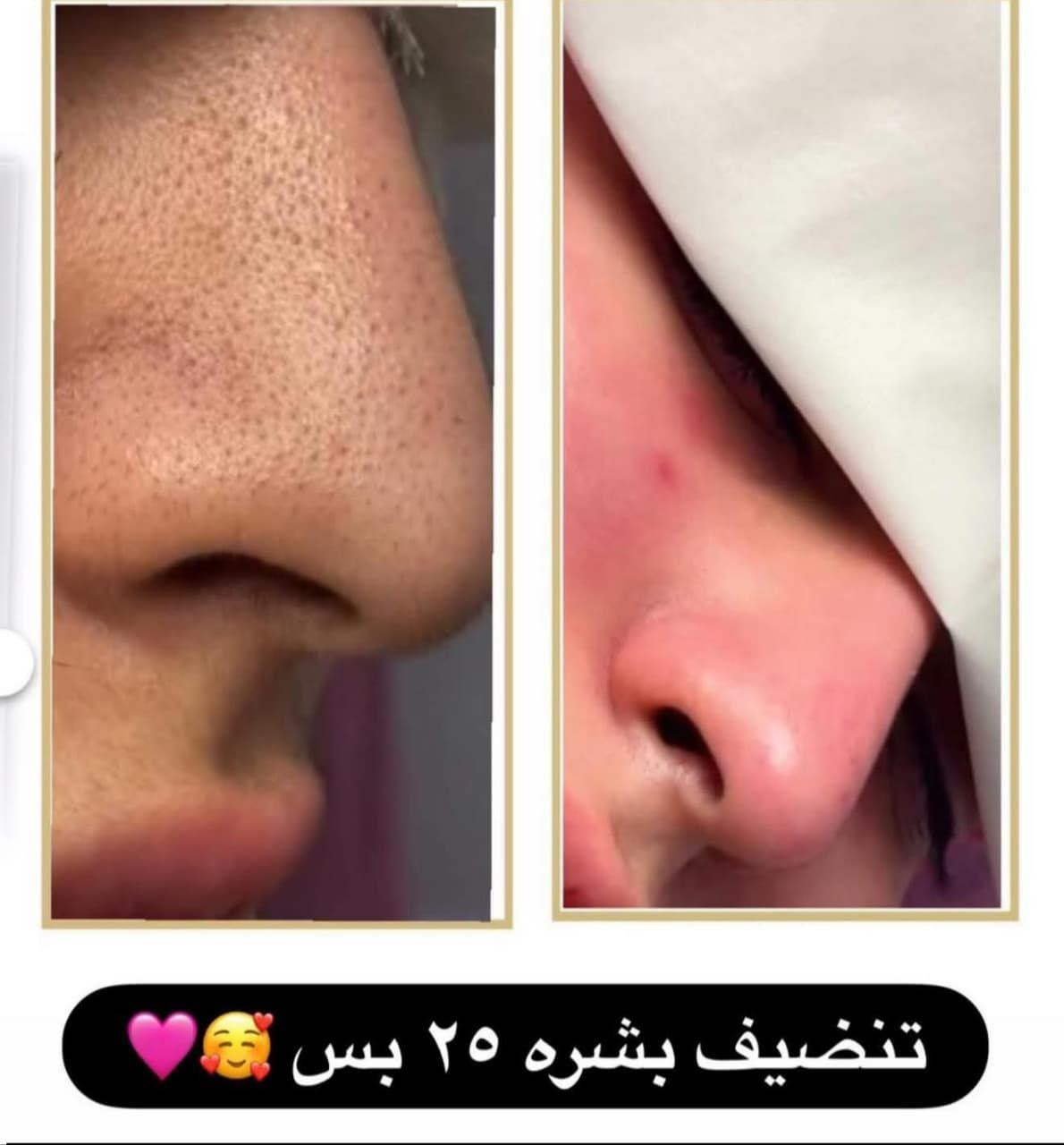 "لأنكِ تستحقين لحظة من الجمال.. صممنا لكِ عالماً من الدلال."
​"لا نغير ملامحك، بل نبرز أجمل ما فيكِ."
​"كوني النجمة التي تضيء في كل مكان.. بلمساتنا السحرية."
​"ثقتكِ تبدأ من هنا.. دللي نفسكِ كما لم تفعلي من قبل."
حله حي الاساتذه الثانيه شارع المستوصف للحجز والاستفسار الاتصال على رقم *********** حلة, بابل
