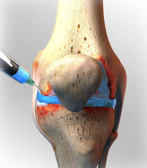 ١.علاج السوفان بحقن البلازما و الخلايا الجذعية و الابر الجلاتينية  بدلالة السونار
٢.علاج انزلاق الفقرات القطنية والعنقية بجهاز سحب الفقرات الكهربائي
٣.علاج نتوء الكعب بجهاز تفتيت التكلسات
٤. علاج المفاصل بالليزر البارد الحديث
٥. العلاج آلام المفاصل بالابر الصينية
٦. تأهيل اصابات الاعصاب و الكسور بأجهزة التحفيز الكهربائي و الحمام الشمعي
٧. فحص هشاشة العظام 
الدكتور الإختصاص احمد صلاح اختصاص أمراض المفاصل و الروماتيزم و التأهيل الطبي 
بغداد.حي الجهاد .استدارة السوق الشعبي مقابل إنشائية البشير ٢
للحجز والاستفسار 
***********
