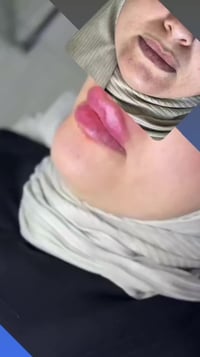 عروض حلوة • عيادات العاصمة • واتساب