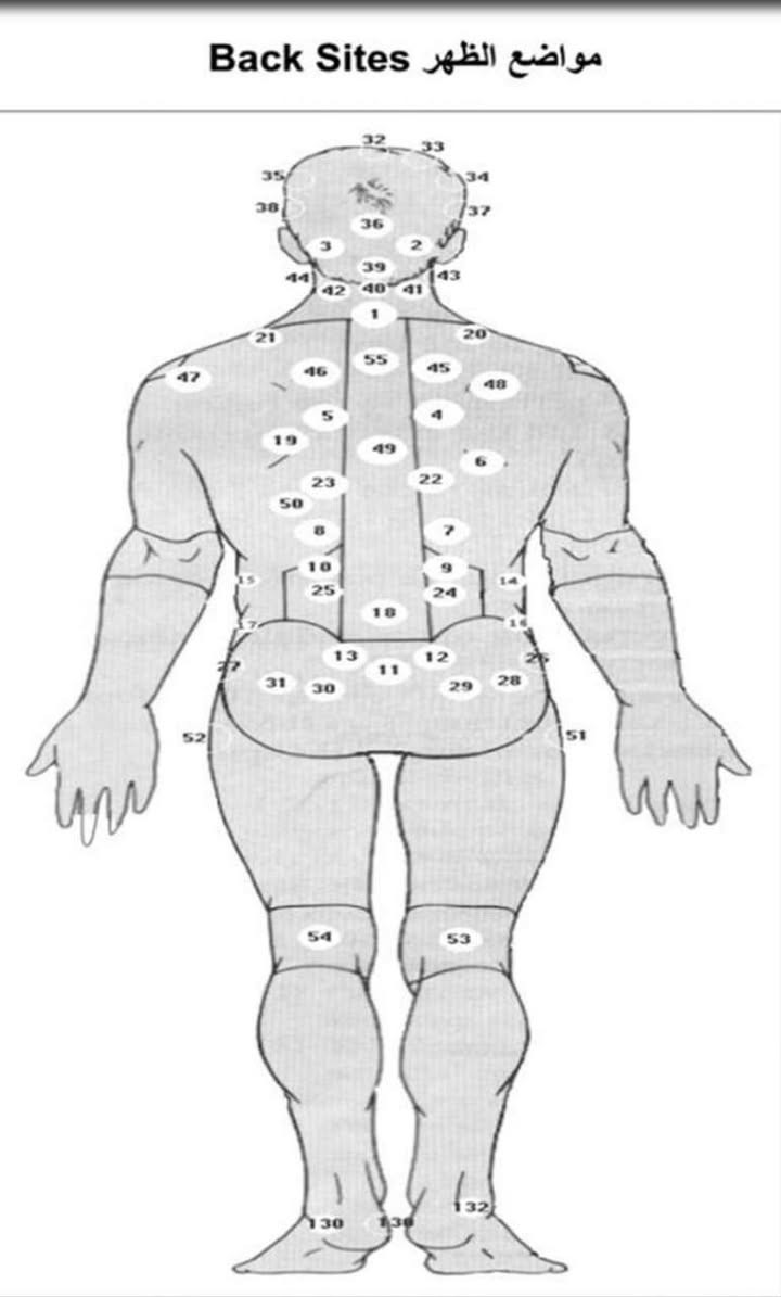 بسم الله الرحمن الرحيم 
قال رسول الله (ص) (ان  أفضل ما تداويتم به الحجامة، أو هو من أمثل دوائكم) 
( إن كان في شيء, من أدويتكم - أو يكون في شيء, من أدويتكم خير ففي شرطة محجم, أو شربة عسل,، أو لذعة, بنار, توافق الداء، وما أحب أن أكتوي) 
يسرنا عن علاج اغلب ومعظم الحالات المرضية بالاساليب العلمية المتطورة منها علما ان الحجامة الوقائية  ( 5000)
والحجامة المرضية ١٠ الف 
١-  علاج خشونة الركبة
٢_  علاج عرق النسا
٣_ علاج النقرس
٤_ علاج خشونة المفاصل 
٥_ علاج الذئبة الحمراء 
٦_ علاج الروماتيد ( التهاب المفاصل) 
٧_ الشلل النصفي الطولي 
٨_ الصداع 
٩_ التبول اللاارادي 
١٠_ خمول المخ 
١١_ التخلف العقلي 
١٢_ الصرع 
١٣_ التهاب الاعصاب الطرفية 
١٤ _ الشلل الوجهي ( التهاب العصب السابع) 
١٥ _ مرض السكري 
١٦_ التهاب المرارة
١٧_ قرحة المعدة 
١٨_ علاج الضغط المرتفع 
١٩_ علاج الامساك 
٢٠ _ علاج الاسهال 
٢١_ علاج القولون العصبي 
٢٢__ علاج التهاب الكبد الفايروسي 
٢٣_ امراض القلب 
٢٤ _ تضخم الغدة الدرقية وزيادة افرازها 
٢٥_ التهاب البروستات 
٢٦_ علاج دوالي الخصية 
٢٧_ علاج الناسور الشرجي 
٢٧_ علاج البواسير 
٢٨_ علاج دوالي الساقين 
٢٩_ التهاب الاذن الوسطى 
٣٠_التهاب الجيوب الانفية 
٣١_ التهاب الحنجرة 
٣٢_التهاب اللوز
٣٣_ الامراض الصدرية 
٣٤_ علاج الثعلبة (القراع) 
٣٥_ علاج البهاق البرص 
٣٦_ علاج الضعف الجنسي 
٣٧_ علاج عقم الرجال 
٣٨ _ علاج امراض العين 
٣٩_ صعوبة النطق 
٤٠_ علاج العصب الخامس
العنوان الهوير _ فلكة الخاص 
هاتف : ***********
