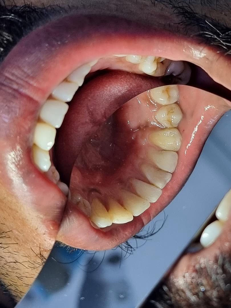 ابتسامتك تبدأ من أسنان نظيفة وصحية ✨

تنظيف الأسنان بشكل دوري يساعد على إزالة الترسبات والجير، ويحافظ على صحة اللثة ويمنحك نفسًا منعشًا وابتسامة أجمل. 🦷💙

#عيادة_كوثى_لطب_وتجميل_الاسنان
#الدكتور_علي_حسن_العزاوي 
جبله/نهاية شارع الاطباء
مقابيل الدكتوره ميثاق المعموري

***********//للاستفسار
