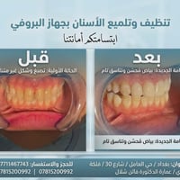 الابتسامة الحلوة مو بس تزيد الثقة، تغير الملامح كلها! 😉✨ ​شوفوا الفرق ...