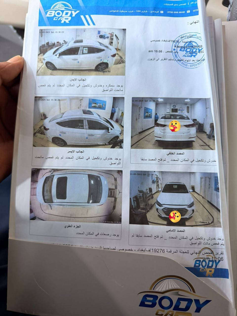 من رخصت الادمن المحترم
النترا 2017 خليجي رقم بغداد مكفوله من صبغ بيه اقل الشبر ع البارد كير محرك كفاله ماشيه 140 محرك بلادي وهاذ سونارها موضح بي كلشي عارضه 160 بيه مجال يرهم مراوس مكان سياره رمادي***********
