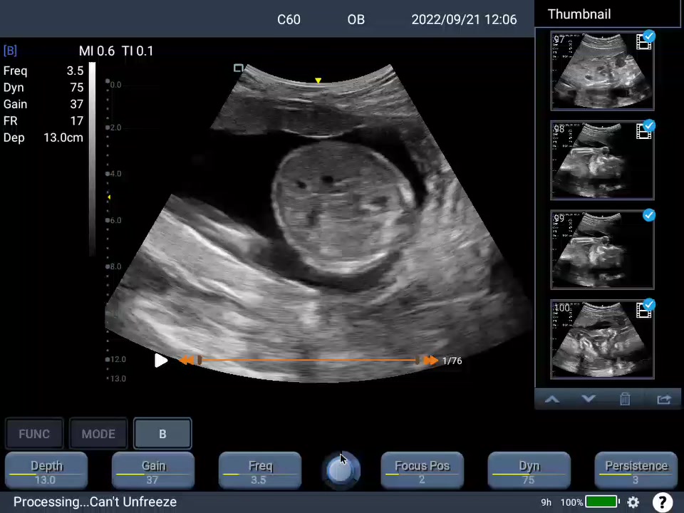 السلام عليكم
جهاز سونار للبيع مع كافة ملحقاته للاستفسار الاتصال على هذا الرقم ‭٠٧٨٠ ١٦٢ ٢٥٩٠‬
