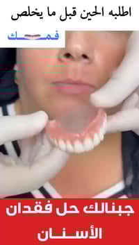 طقم أسنان مرن • جودة عالية • توصيل مجاني