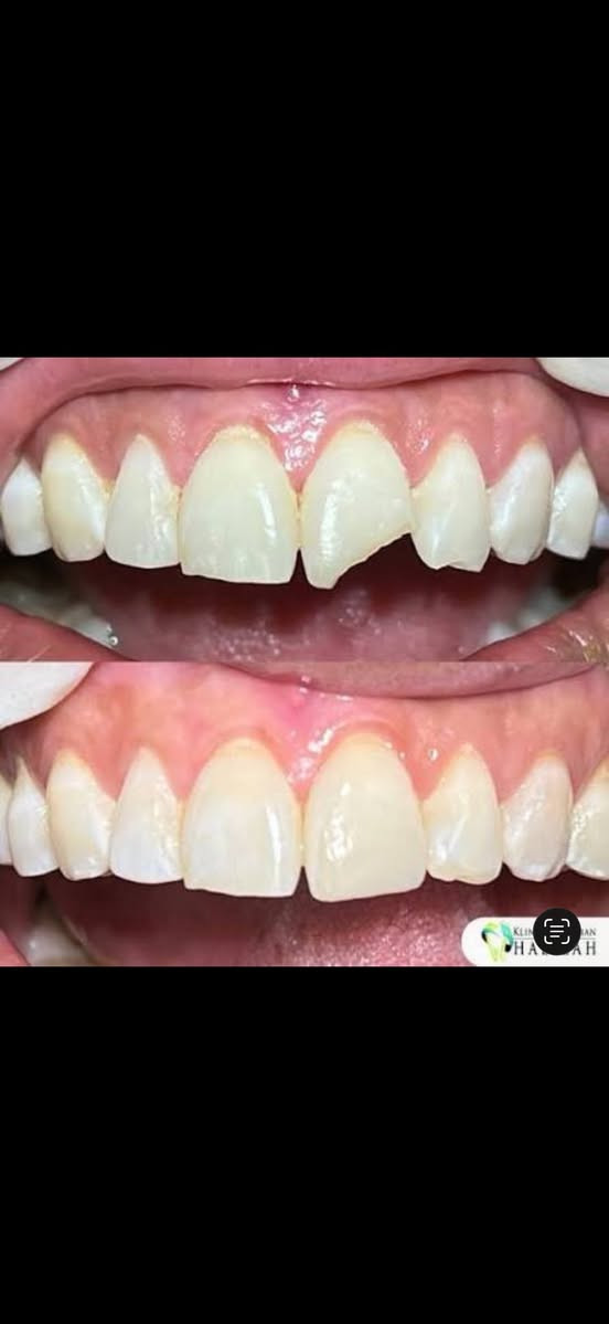 🔴🔴مجانا مجانا🔴🔴 
 إلى اهالي كربلاء والمناطق القريبة اي شخص عنده هيج حالة وماعنده امكانية يراسلني اعالجه مجاني 
للحجز والاستفسار راسلونه خاص واتساب: ***********
العنوان :كربلاء-الحولي-مجاور العاب ضوء القمر-بناية جوتن -عمود١٣٣٨
متواجدون يومي الثلاثاء والاربعاء من الثامنة صباحاً الى الواحدة ظهراً
