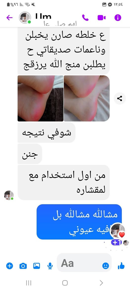 كلنه نعرف جمال المره ونظافتها تبدي من اقدامها 😎😎💜 لكل يعاني من تشققات القدم والخشونه الي تصير بيها من هسه لاتشيلين هم شي وفرتلكم المنتج يساعدكم ع التخلص من تشققات وخشونة الاقدام  ب اسبوع واحد فقط وتصير اقدامكم ورديه وناعمة مثل الأطفال واكثر😍💜💜
القدم بكج خاص لقدم 
فوأدها : 
1- تزيل تشققات القدم 🦶🏻
2- توريد القدم 🦶🏻
3- تنعيم وازالة رائحه القدم 🦶🏻
4يزيل فطور القدم
 لطلب مراسلة الصفحة خاص ✅✅💙
كلنه نعرف جمال المره ونظافتها تبدي من اقدامها 😎😎💜 لكل يعاني من تشققات القدم والخشونه الي تصير بيها من هسه لاتشيلين هم شي وفرتلكم المنتج يساعدكم ع التخلص من تشققات وخشونة الاقدام  ب اسبوع واحد فقط وتصير اقدامكم ورديه وناعمة مثل الأطفال واكثر😍💜💜

كلنه نعرف جمال المره ونظافتها تبدي من اقدامها 😎😎💜 لكل يعاني من تشققات القدم والخشونه الي تصير بيها من هسه لاتشيلين هم شي وفرتلكم المنتج يساعدكم ع التخلص من تشققات وخشونة الاقدام  ب اسبوع واحد فقط وتصير اقدامكم ورديه وناعمة مثل الأطفال واكثر😍💜💜


**إذا كنت صاحب هذا الإعلان وتريد حذفه لأي سبب، رجاءا أرسل رسالة إلى الدعم الفني**