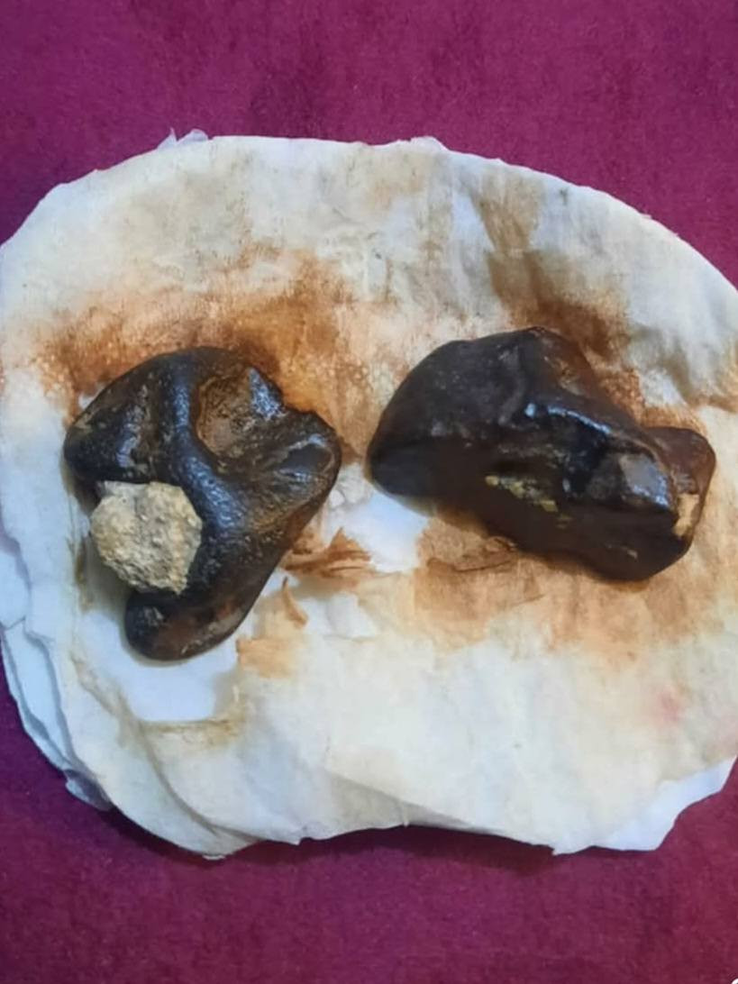 الي يدور على حجر الهبهاب الطبيعي 

هذه حجر الهبهاب الطبيعي الخام وخواصه معروفه 
محبه شديده 
جلب محبة الناس لحامله 
تحسين العلاقات عامة وخاصة 
تفاصيل على الخاص بغداد, العراق


**إذا كنت صاحب هذا الإعلان وتريد حذفه لأي سبب، رجاءا أرسل رسالة إلى الدعم الفني**