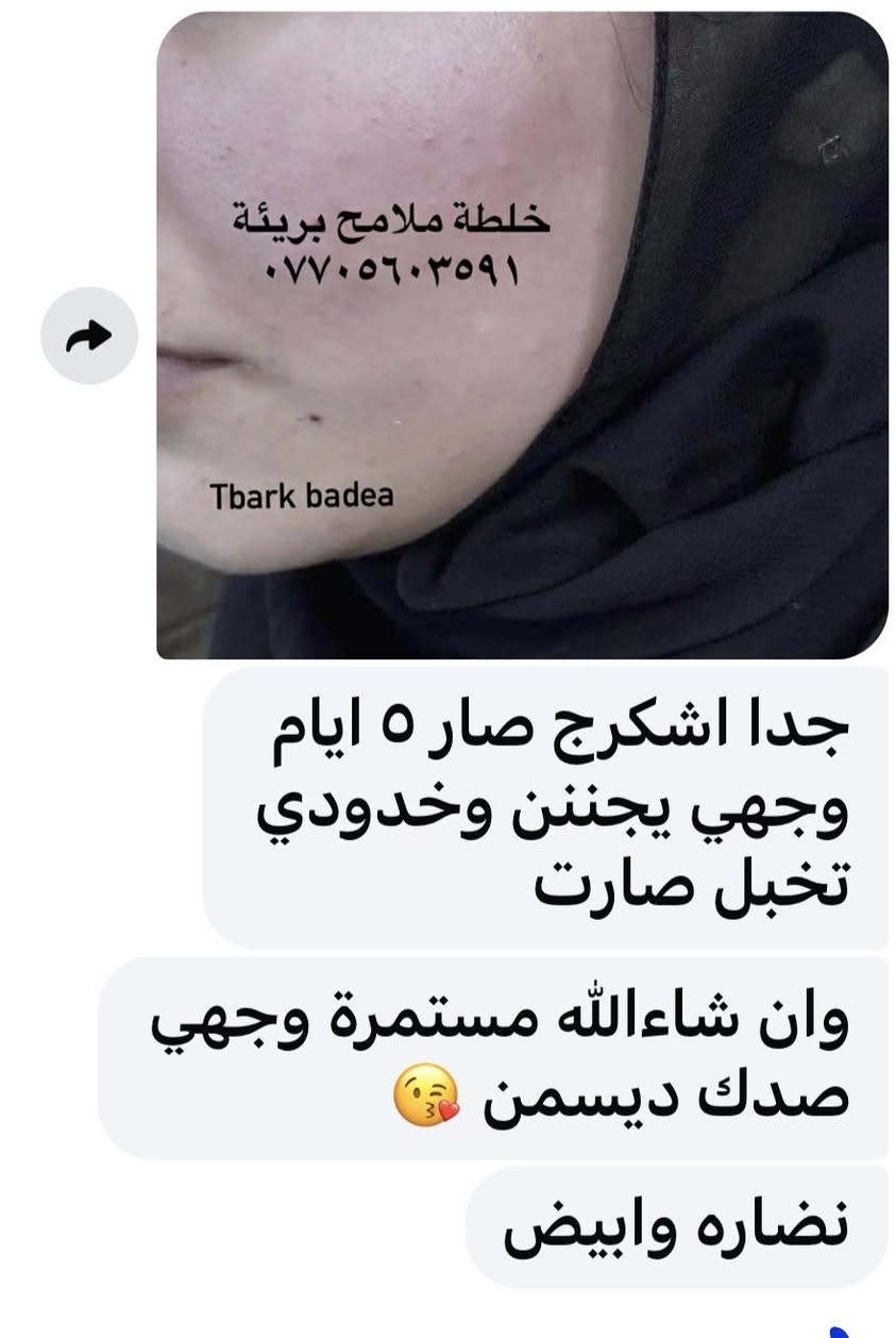 وتستمر خلطة ملامح بريئة بأثبات مفعولها بنتائج مبهرة 🫶


**إذا كنت صاحب هذا الإعلان وتريد حذفه لأي سبب، رجاءا أرسل رسالة إلى الدعم الفني**