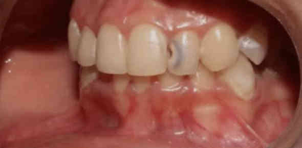 السلام عليكم 
الي عنده هيج تسوسات او كسر بالسن محتاج قلع نكدر نعالجهم مجاناً في عيادات الجامعه الوطنيه 
(العمل مجاناً وباشراف اطباء اختصاص )
للاستفسار:***********
