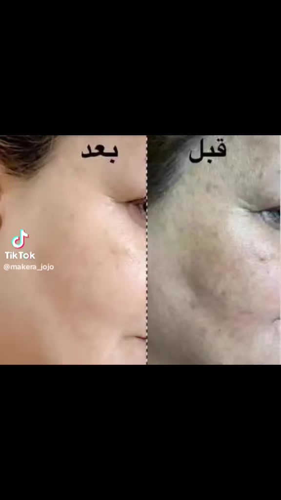 إبرة الكالسيوم شغلهه رهيب ولا غلطه


**إذا كنت صاحب هذا الإعلان وتريد حذفه لأي سبب، رجاءا أرسل رسالة إلى الدعم الفني**