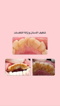 اسنان مجاني • علاج اطفال • جامعه العميد كربلاء