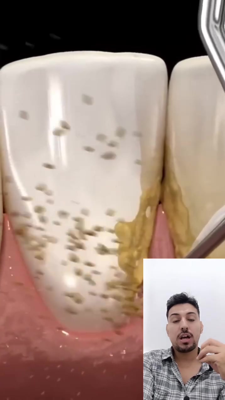 فرشة الاسنان وحدها غير قادرة على ازالة التكلسات
#د_ماهر_الخفاجي


**إذا كنت صاحب هذا الإعلان وتريد حذفه لأي سبب، رجاءا أرسل رسالة إلى الدعم الفني**