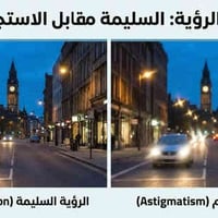 عيادة عيون • الديوانية • ماء أبيض