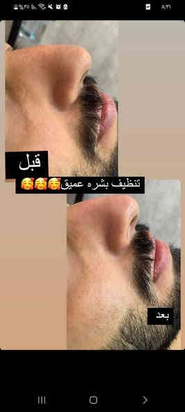 صالون فوفو بيوتي للتجميل
عـروض

عرائس: ميكب وتسريحة ورموش وعدسات وبدلة عرس بـ 150 ألف.

الطالبات: تنظيف VIP ورموش دائمة وبدلتها مفعّلة بـ 100 ألف.

عرض أكريلك: أكستنشن مع تقشير وتنظيف اليد والقدم بـ 35 ألف.

تنظيف بشرة VIP مع إبره الليمونتال مع بدلتها مفعّلة بـ 65 ألف.

صبغ شعر قصير وتحصيل مع معالج تريتمنت بـ 35 ألف.

صبغ شعر متوسط وتحصيل مع معالج تريتمنت بـ 50 ألف.

صبغ شعر طويل وتحصيل مع معالج تريتمنت بـ 65 ألف.

للخريجات: رموش وميكب وتسريحة وأكريلك بـ 65 ألف، وكل طالبتين الثالثة مجاناً.

الموقع: زيونة – تقاطع ميسلون
للاتصال:
***********
***********
