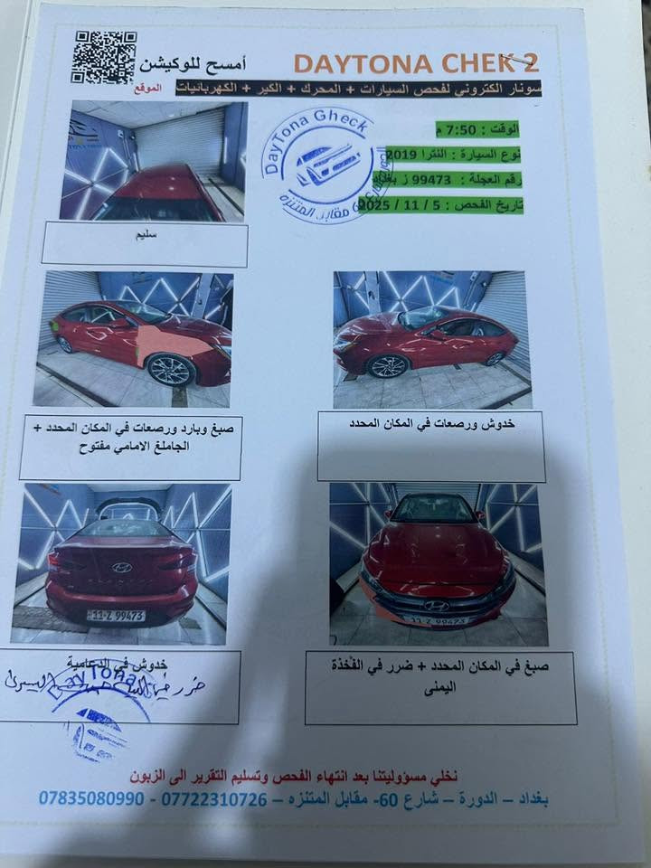 السلام عليكم النترا وارد امريكي
بغداد 

للبيع موديل 2019

السعر127$بيها مجال

صور الحادث مرفقه بالسونار

نص فول 

تدفئه 

تبريد شغال 

الاتصال ***********

تره الضربهً مواصله للفخذه بس دكه جاكوج بدايتها يكدر  يفحصها خلي يفحصها باي مكان يعجبه
