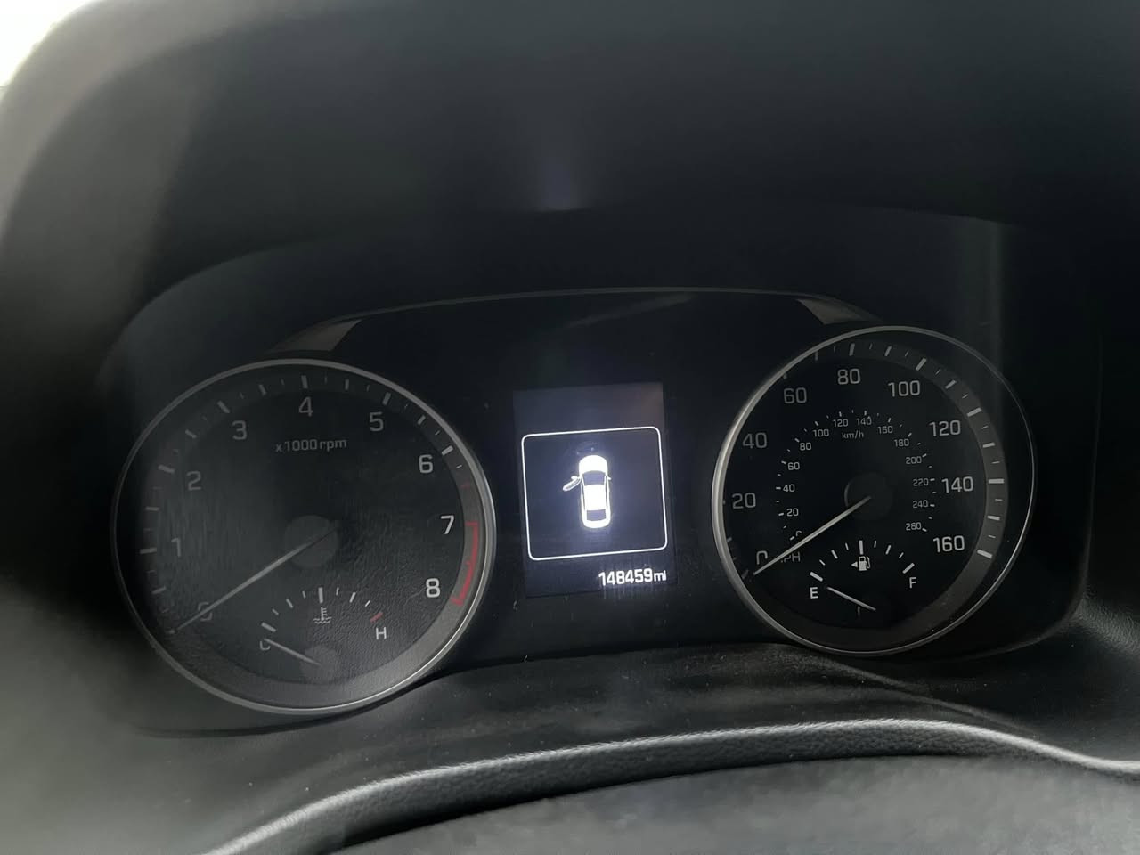 السلام عليكم مكلف بلنشر للتواصل ع الرقم
النترا موديل 2018 اربيل 
مكينه دوش 2000
شاشة
وارد امريكي 
كامرا دواره
السعر 120 و بي مجال بسيط
مكاني بغداد بسماية
***********
