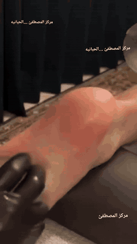 .      ............اسلام عليكم مركز المصطفئ................

                الحجامه . لعلاج طبيعي . المساج

نزلاق لفقرات والصابات رياضيه وتكلسات وجلطات دماغيه وشلل اطفال 

المكان الانبار .. الحبانيه سوق لعصري مقابيل لقاعه وعطور الماهر رقم لهاتف ***********
