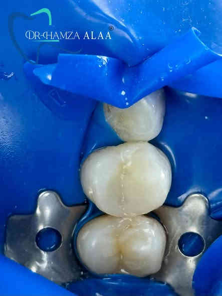 العنوان بسماية الشارع العام 📍
  للتواصل مراسلة الصفحة 📩
 او عن طريق الواتساب *********** 📞
