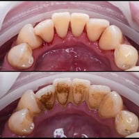 اللي محتاج تنظيف موجودين باجر شارع فلسطين ب12 ظهراً، للتواصل واتساب : ...