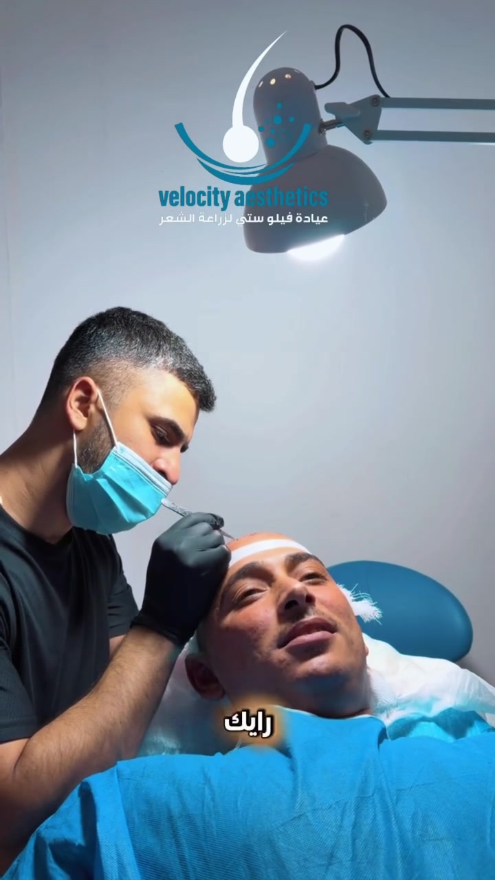 🌐الكثافه الي تحلم بيها صارت ممكنه 💎
     💤مركز فيلو ستي لزراعه الشعر💤
💠بااشراف الدكتوره امان زيد رشيد💠
💠🌀نجري زراعه الشعر بعدد مفتوح من البصيلات بافضل واحدث التقنيات العالميه في عالم الزراعه بكثافه ١٠٠٪؜ وبرسمه طبيعيه

شعرك .. جمالك .. ثقتك 💠

اختياركم النه هو سر نجاحنا🌐

بعدنه مستمرين وياكم بعروضنه

        💤💠العرض الذهبي💠💤

🔹الشغل الدقيق والكثافه العاليه 100‎%‎ 

 🔷عدد بصيلات مفتوح يصل الى (7000)  
      الف بصيله او اكثر      

 🔹فتح القنوات بتقنيه الزفير
        💤الاحدث عالميآ بالزراعه💤

✅كادر طبي مختص بزراعة الشعر  🩺
✅حقيبه علاجيه متكامله بعد الزراعه 🧳
✅10جلسات بلازمه مفعله 💠
✅10 جلسات ميزو ثيرابي اسباني للشعر المزروع 🌡🩸
✅3جلسات ميزو وايت نظاره للبشره
✅جلسه تنظيف البشره
✅سحب عدد مفتوح من البصيلات مع    ✅ضمان عدم حصول اي تشوه في المنطقه المانحه  📝 
✅تحاليل شامله قبل العمليه 🧪
✅معاينه مجانيه لمده سنه بعد العمليه 
✅غسل الشعر المزروع لمده 10 ايام 
      بعد العمليه🚿
✅وجبة طعام صحيه اثناء العمليه 🍱🌮
✅شهاده ضمان مدى الحياة بكثافه وعدم تساقط الشعر المزروع 
      

💠🕊️ ((متوفر نظام الاقساط))🕊️💠
💎القسط الشهري وبدون مقدمه✔️
💎لحاملي بطاقة الماستر كارد ✔️
 💎الرافدين حصراً والاستقطاع الكتروني ✔️
💎لجميع الموظفين والمتقاعدين 🔹
💎وابطال وزارة الداخلية والدفاع🔹

🌐💎العنوان :- بغداد /المنصور شارع مطعم هيل وزعفران

   🔹للحجز والاستفسار اتصال 📞 :-
                                     0774 658 9352
0786 022 2922
