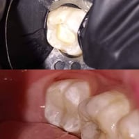 عيادة أسنان • زراعة أسنان • قضاء البدير