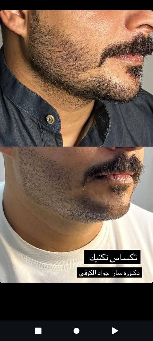 عنواننا النجف ركن السلام جامعه(الاربع شوارع) مجاور ازبري قرب يو كافيه
https://www.instagram.com/reel/DVoo2aKjQVT/?igsh=Mzd2cjQydXVzMXRiللحجز ***********
