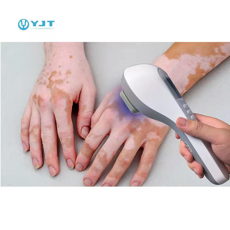 🔥 جهاز UVB 308 للعلاج الضوئي المنزلي – فعّال لـ:

🔹 البهاق (Vitiligo – Fehér foltok)
🔹 الصدفية (Pikkelysömör)
🔹 الأكزيما (Ekcéma)

هل تعاني من الصدفية، البهاق، أو الأكزيما؟ 👋 بدلاً من زيارات المستشفى المتعبة، جهاز UVB الضوئي يمنحك العلاج في منزلك بأمان وفعالية.

✨ لماذا هذا الجهاز؟

· ✅ يعالج الأعراض والسبب الجذري للمشكلة
· ✅ علاج منزلي بدون تكاليف إضافية أو زيارات مستشفى
· ✅ طيف ضيق 308 نانومتر – دقيق وآمن
· ✅ خفيف وقابل للحمل (أبعاد 25×17×8 سم)
· ✅ شاشة رقمية + مؤقت عد تنازلي + أزرار تحكم (+/-)
· ✅ بطارية داخلية ومنفذ شحن + فتحات تبريد

· الموديل: UL-01
· الجهد: محول عالمي 100-240 فولت (خرج 12V/4A)
🔹 معتمد CE + ضمان

جهاز UVB 308 هذا مخصص للعلاج الضوئي المنزلي هو نفس التقنية المستخدمة في المستشفيات لكن بحجم صغير تستخدمه لمدة دقائق حسب الجرعة الموصى بها. 

✅ الاستخدامات الطبية للجهاز:
علاج البهاق وتحفيز صبغة الجلد.
التخفيف من الصدفية وإزالة القشور.
تهدئة الإكزيما الحادة والتهابات البشرة.

📍 الموقع: العراق 🇮🇶
📬 للتواصل والاستفسار: يرجى إرسال رسالة خاصة على المسنجر، أو واتساب 
واتساب/ ‭0776 328 9823‬
