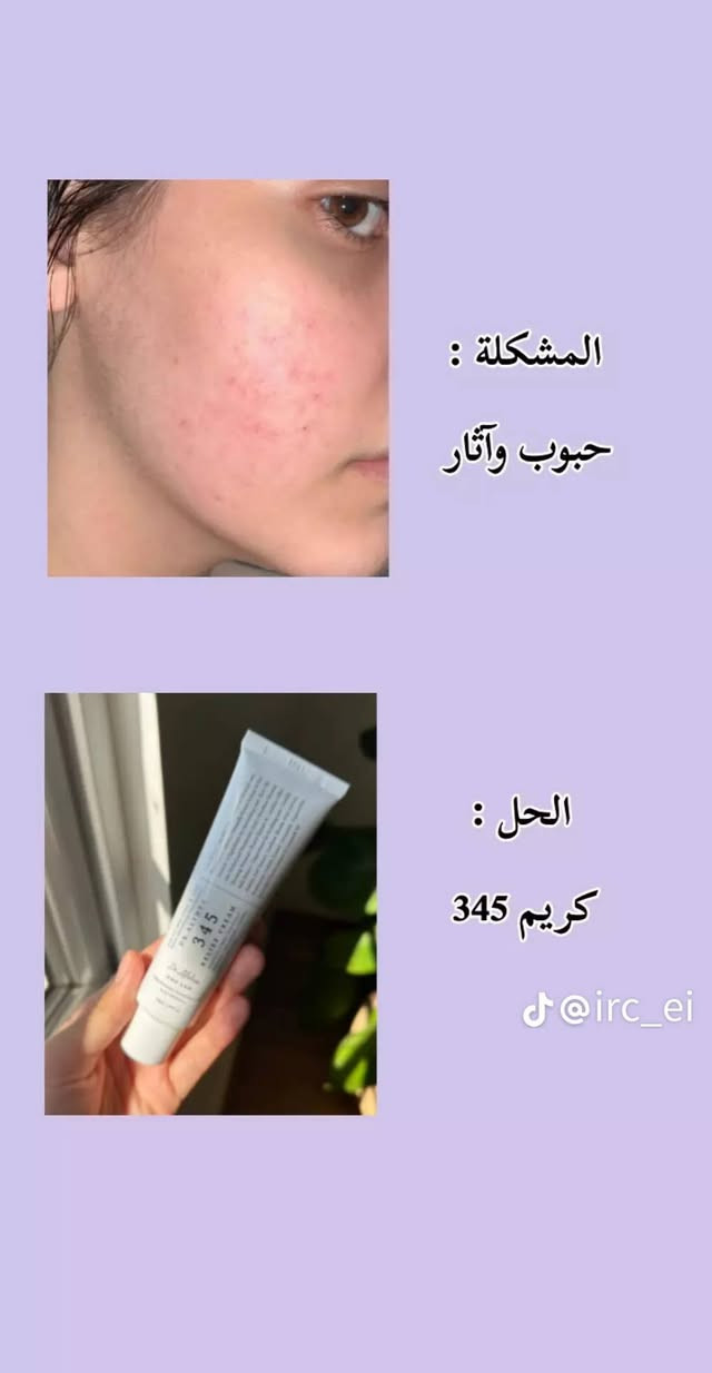 مرحبا عيني متوفر عندي مكياج شيكلام وعنايه اسعار كولش مناسبه ورخيصه الله شاهد للحجز خاص او رقم الواتساب ***********
 الي تحب تابعني عله صفحتي تيك توك واتشرف بيهه hnynbrand@
متوفر عندي توصيل جميع المحافضات
