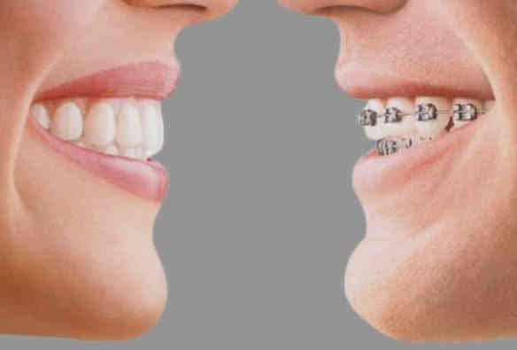 السلام عليكم 
منو محتاج 
قلع 
عيادة اطفال: (قلع ،حشوات ،تنظيف الاسنان) 
تقويم 
حشوات تجميلية ومعدنية
تعويض الاسنان المفقودة بطقم متحرك
فاقد اسنان فك كامل او احدى الفكين 
تنظيف الاسنان من التكلسات
يتواصل وياي 
العمل مجاني بغداد الكراده شارع 52عيادات جامعة ارووك ***********وتساب
