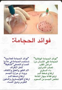 حجامة أربيل • تعقيم كامل • خصوصية نساء