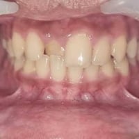 الي محتاج علاج تقويم مثل هل حالات  بلصور لعمر 15 واقل مجانا يراسل علرق...