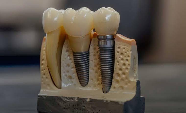 عيادة الكرامه لطب الاسنان متواجدين اليوم في تمام ساعه ٧ مساءً
عنوان جنوب الموصل ناحية الشورة داخل القيصريه مجمع بركات الغيث
***********
