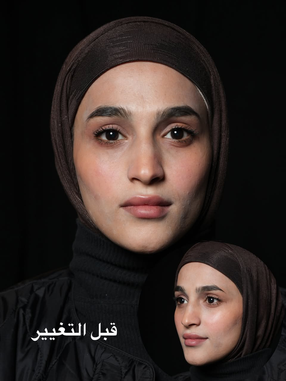 ال glow up الحقيقي 
أقوى عروضنا للتغيير الشامل تلكوها بآخر صوره 
سارانا للتجميل والجلدية والليزر وطب الأسنان 
عنواننا/ركن السلام جامعة (الاربع شوارع( مجاور أزبري قرب يو كافيه 
للحجز ***********
