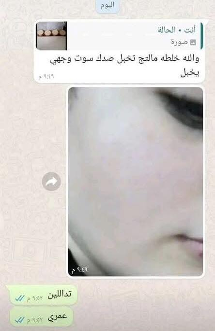 يسعد صباحكم 
تتوفر عندي خلطه سعرها ١٠ الاف توصيل متوفر
خلطه اني استخدمها لنفسي الله شاهد تجنن تسوي الوجهه كزازه تحتوي ع فيتامين سي وتحتوي ع زيت اللوز الحلو ينطي رطوبه ولمعان الوجهه ويخفف الهالات السوداء


**إذا كنت صاحب هذا الإعلان وتريد حذفه لأي سبب، رجاءا أرسل رسالة إلى الدعم الفني**