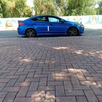 وارد كندي • كاميرا ١٦٠ • فتحة سقف